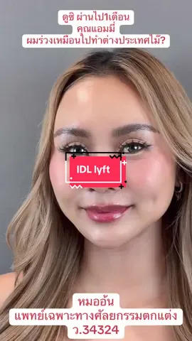 คนไปทำ ต่างประเทศแล้วผมร่วง ใช่ว่าทุกคนทำแล้วจะร่วงนะครับ เพราะฉะนั้นไม่ต้องกลัว  #หมออ้นฉัตรพล  #หมออ้นidl  #หมออ้น  #ยกคิ้วส่องกล้องหมออ้นidl  #idllyft  