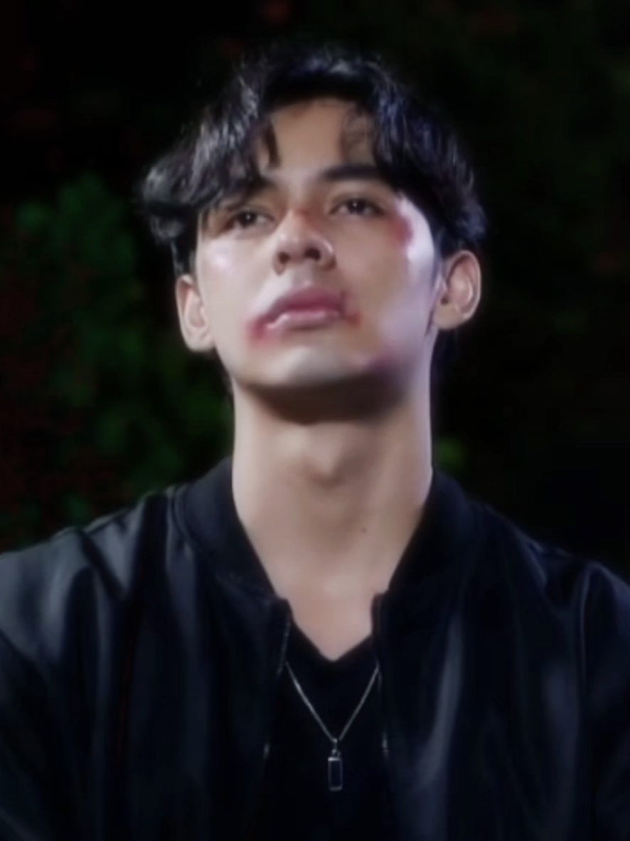 Mood lagi galau, ditambah lagi babakbelur juga, kok bisa tetep cakepp ya fatt🤧#fattahsyach #fyp #fandez #fattahfernandez #agz 