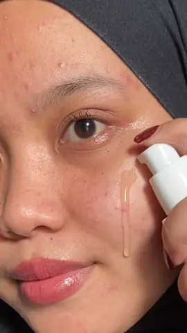 baru pake beberapa hari udah keliatan perubahannya😍 #YOURadianceSeries #YOUSkincare #YOUserum #serumYOU #youradiance 