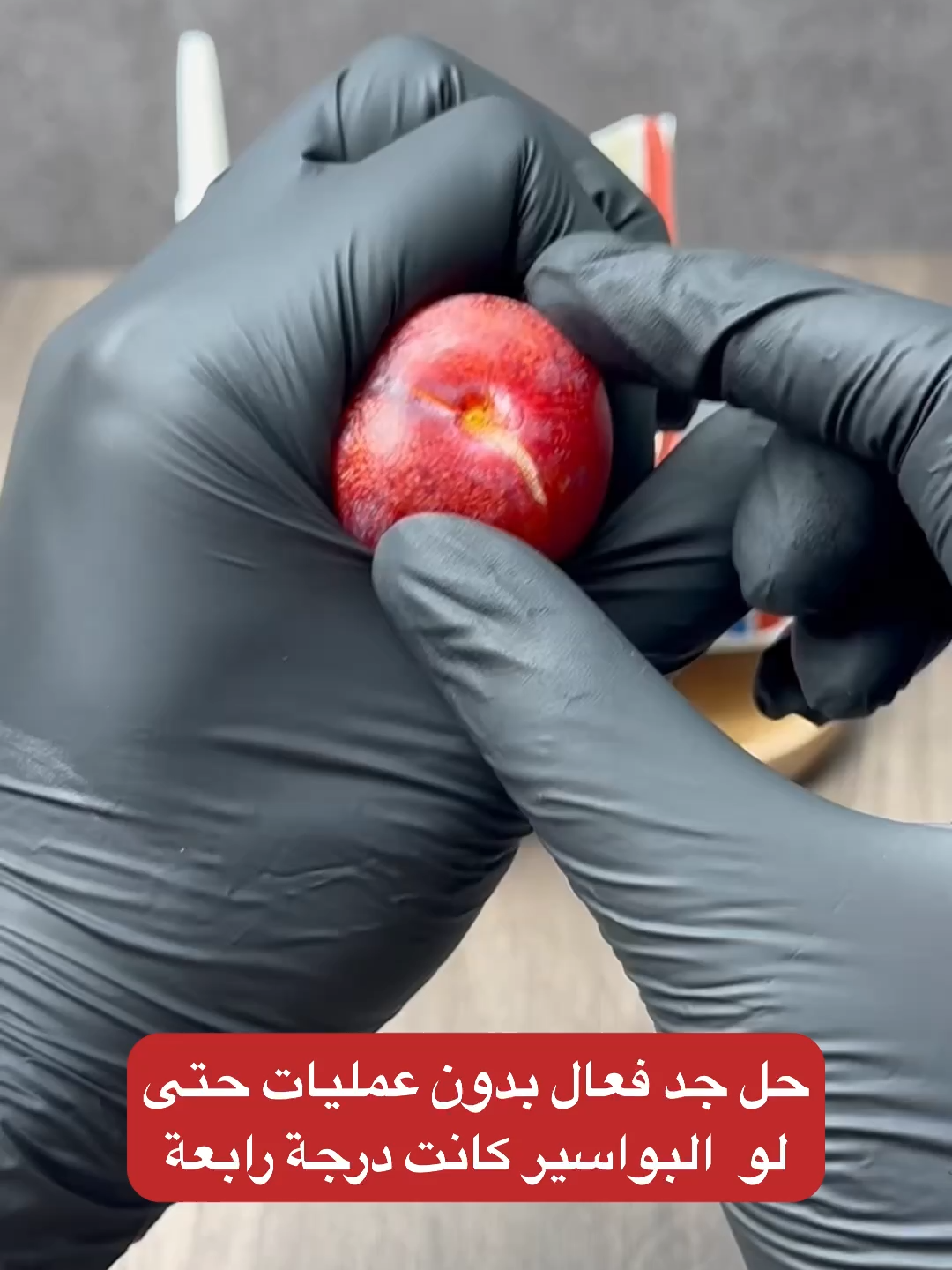 تعاني من حكة أو ألم بسبب البواسير؟ 👀 بخاخ عشبي طبيعي 🌿 يساعدك على الراحة فورًا ✨ تصميم عملي بلا تلامس يدوي ✅ اطلبه الآن عبر الرابط في البايو 🔗 #البواسير #بواسير_داخلية #بواسير_خارجية #الناسور_الشرجي #الناسور_العصعصي #healthy #الصحة #السعودية #الرياض #السعودية🇸🇦 #الخليج #الامارات #قطر #عمان #الكويت #البحرين #fyp #الشعب_الصيني_ماله_حل😂😂
