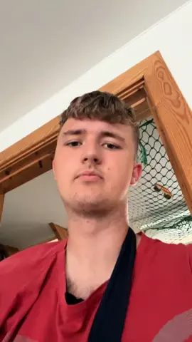 Savner at køre nu hvor jeg har en brækket arm #motorcycle #kawasaki #viral #dirtbike #fyp 