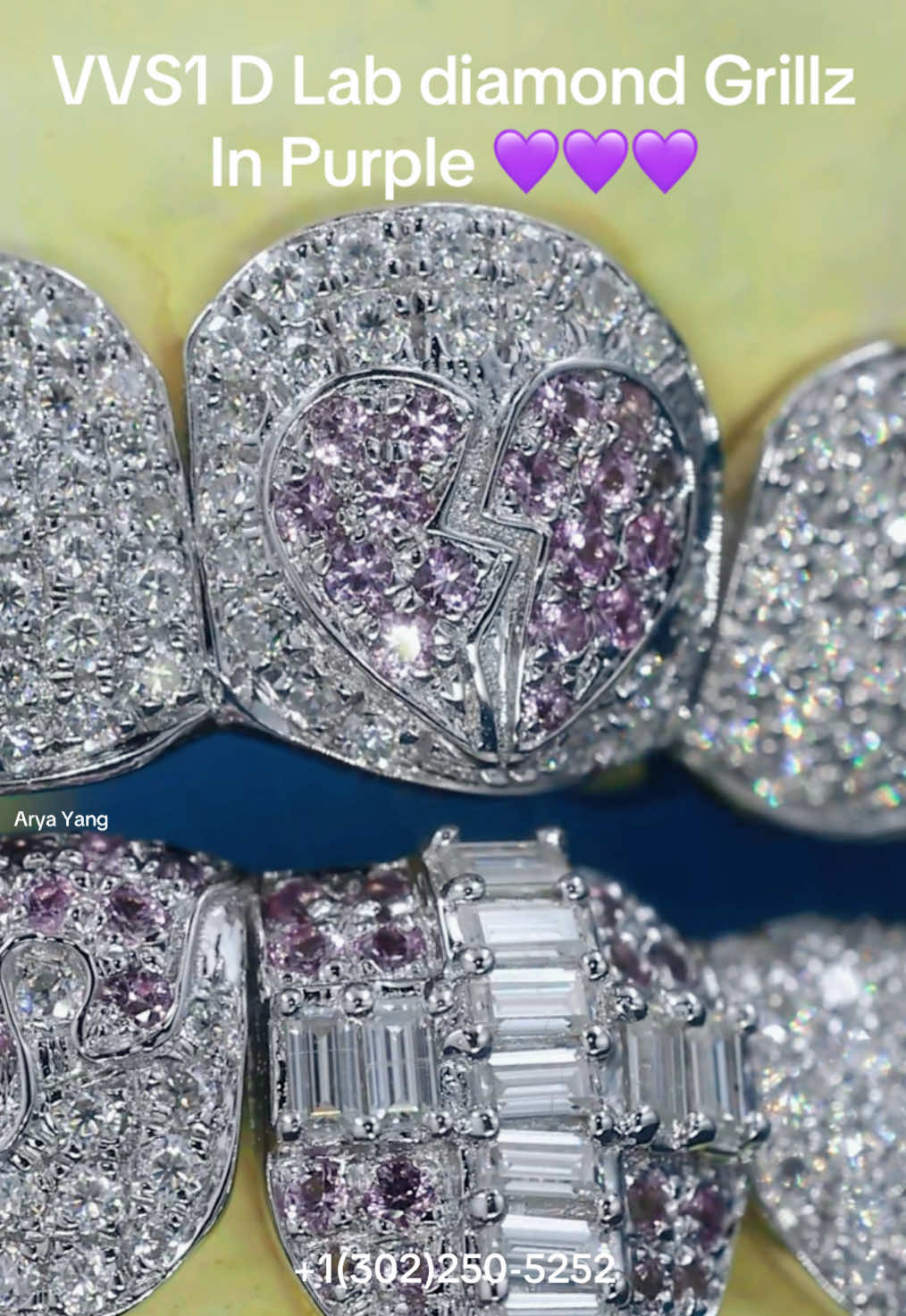 Top and bottom 8 💜Grillz #Grillz #diamondgrillz #hiphopjewelry #foryoupage #viral 