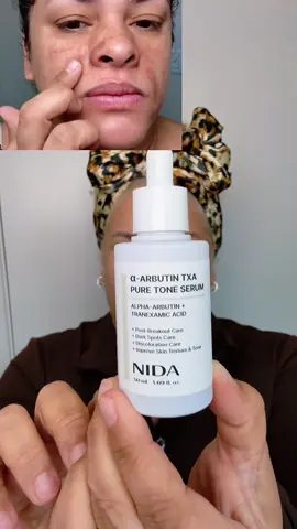Nida serum para eliminar manchas oscuras  #nida #serum #hyperpigmentationskincare #tiktokshopfalldealsforyou #tiktokshopblackfriday 