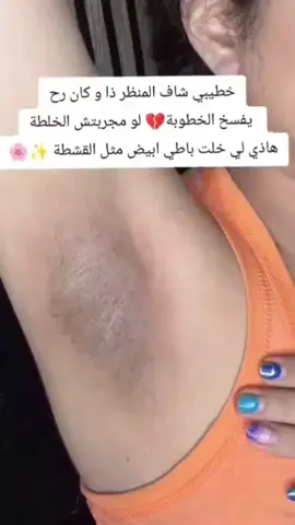 ودّعي الاسمرار والبهتان ✨ مع خلطة التفتيح للمناطق الحساسة من أم سعود 💕 تركيبة طبيعية وآمنة 100%، تعمل بلطف لتفتيح البشرة، توحيد اللون، وتمنحك ملمس حريري ناعم كنعومة الورد 🌸 تعيد النضارة والثقة لأنوثتك من أول استخدام 💫 تفتيح، ترطيب، عناية فائقة في منتج واحد 💖 تفتيح فوري وآمن بدون تحسس توحيد لون البشرة بفعالية نعومة وانتعاش يدومان طويلاً مناسب لكل أنواع البشرة #تفتيح_المناطق_الحساسة #خلطة_ام_سعود #تفتيح_طبيعي #خلطة_تفتيح #عناية_بالبشرة     