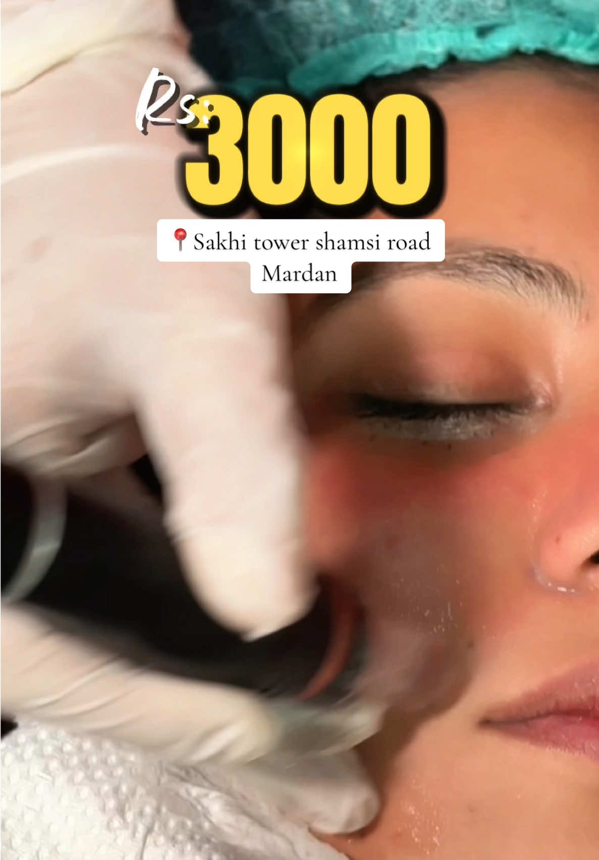 Hydra facial | laser removal | all aesthetic services only in 3k  @i care offers 50% discount on all services  Location:  sakhi tower shamsi road Mardan #HydroFacial #LaserRemoval #LivingWithMilli #AestheticClinic #Mardan 