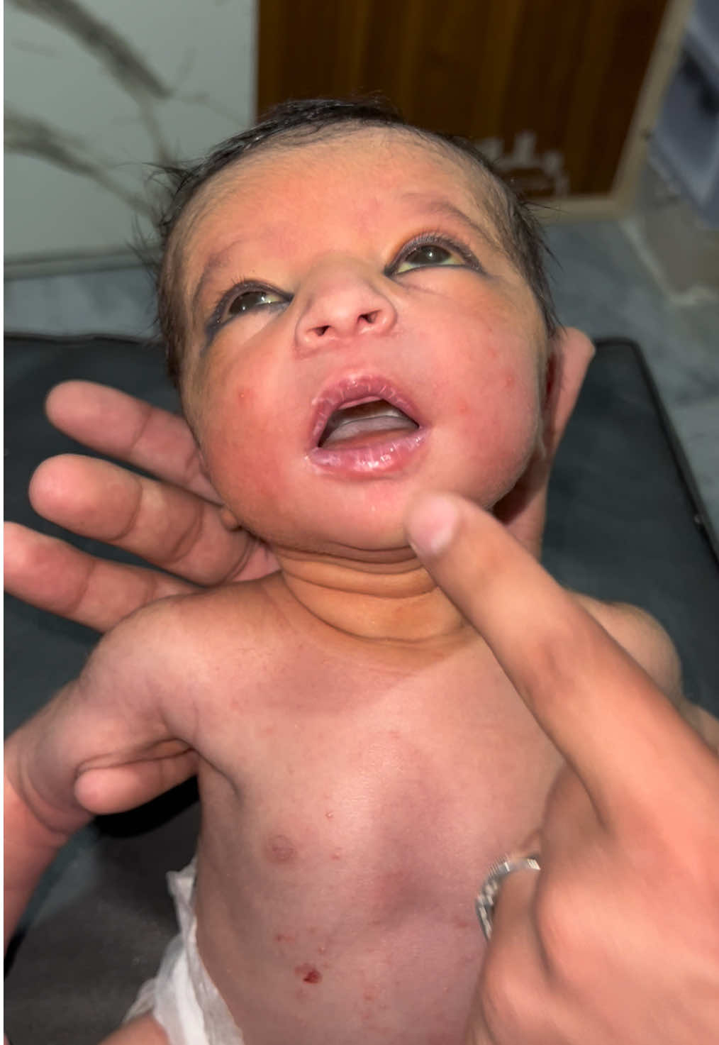 Assessing Newborn Reflexes – Gentle Checkup of Our Adorable NICU Baby 👶💖 #neonatal💕 #newborn🥰 #nicu 