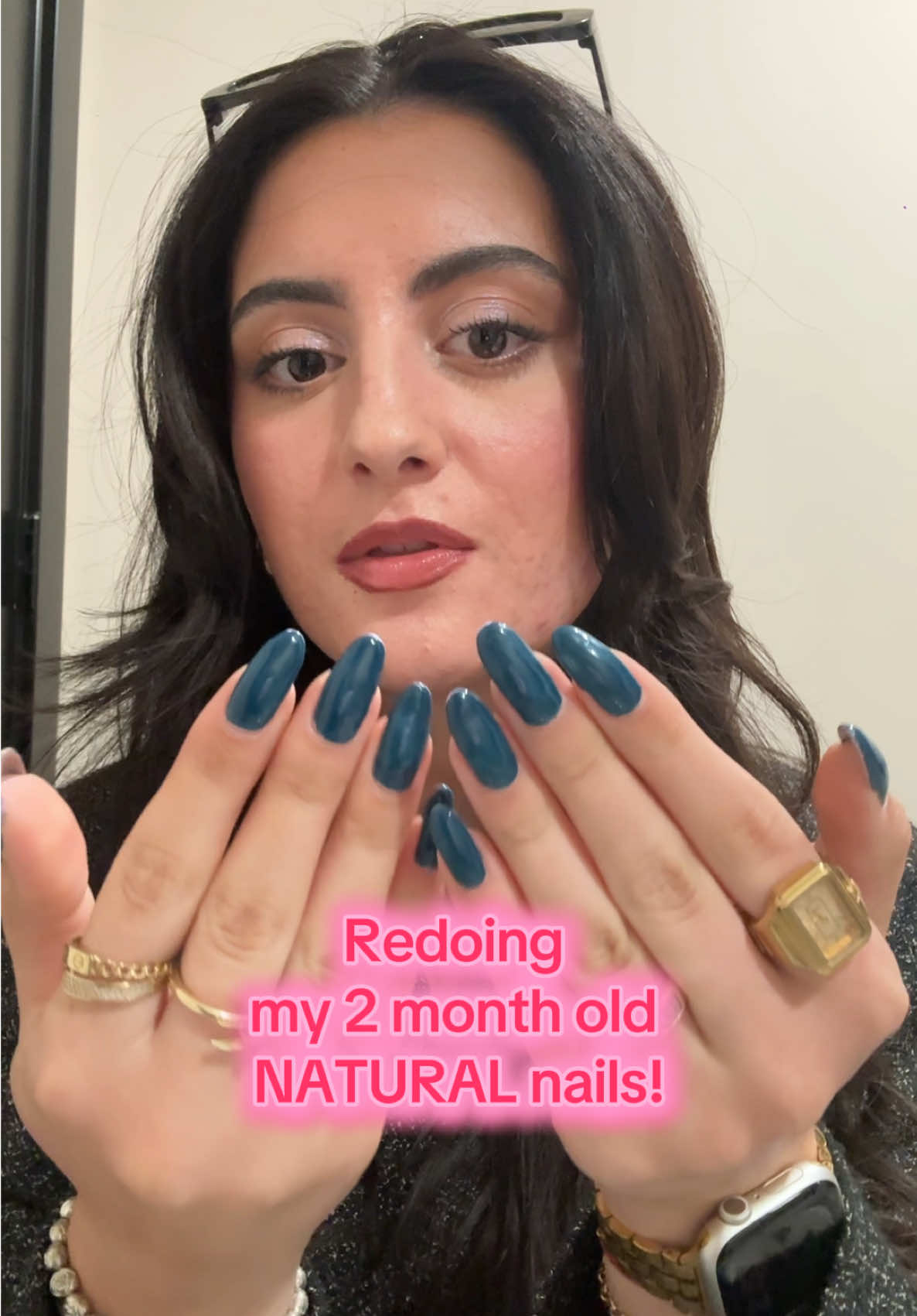 These nails have been on for 8 weeks… it’s time for a nail appointment! 💅🥰💗 #realskintexture #nailday #nailinspo #shellac #beautytips 