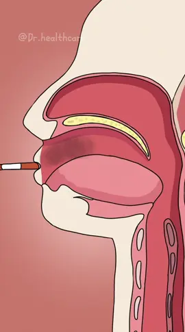 How Your Lungs React When You Smoke