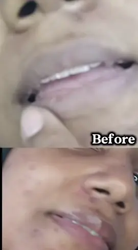 @TALITHA KOUM US #talithakoum #lipcareroutine  #onweeekwithlipcure  #beforeandafter #hydratedlips 