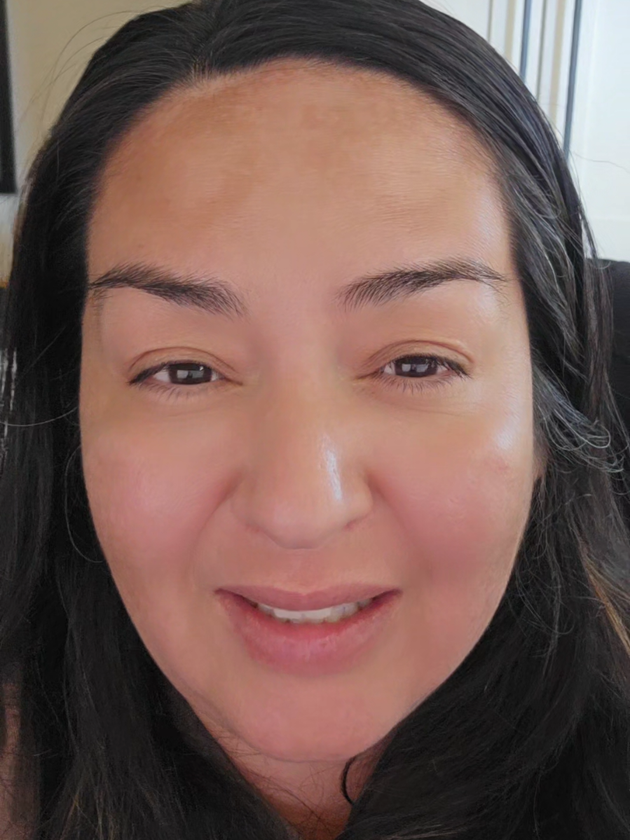 Tinnitus can get you to 100% Service Connected! Here is the list of common diagnoses secondary to Tinnitus. #veteranadvocate #Veterannexusadvisors #nexusletterspecialist #vadisability #military 