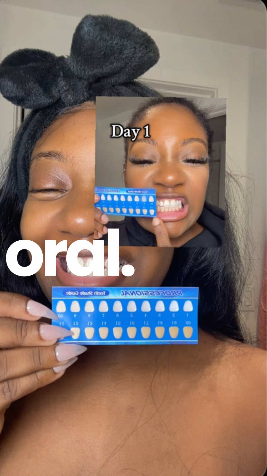 Day 4 of 7 Teeth Whitening #teethwhitening #TikTokShopFallDealsForYou #TikTokShopBlackFriday #TikTokShopCyberMonday #TikTokShopCreatorPicks 