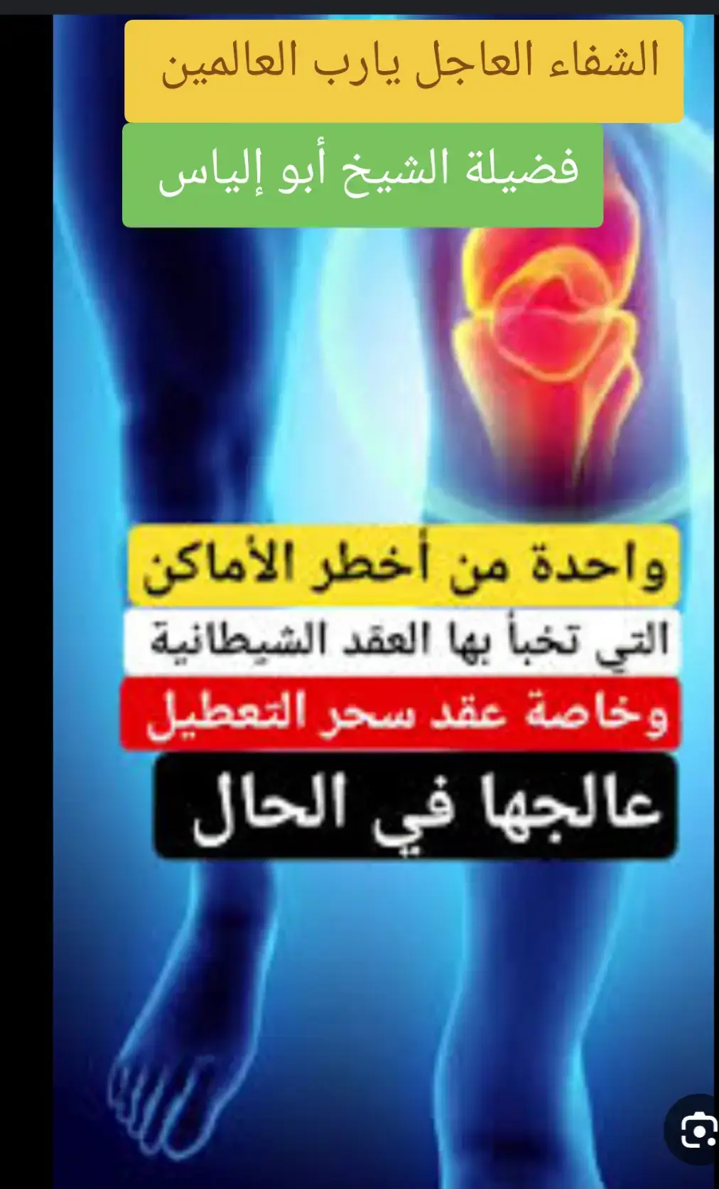 الانسان عن الزواج سواء كان رجل او أمراءة  الكلي : هو تعطيل الانسان عن كل شيء ( درسه . عمل . زواج . سفر. الخ  وكل مشاغل الحياة ) اعراض السحر التعطيل الجزاءي  1 : صداع في كامل الرأس يأتي ويذهب  2 : ضيق شديد في الصدر وخاصة من اوخر وقت العصر الى وقت السحر  3 : كثرة التفكير والشرود الذهني  4 : قلق في النوم  5 : الم في المعدة  6 : الم في اسفل الظهر  7 : احيانا رؤية الخطاب بشكل قبيح  8 : رفض الخطاب بلا سبب  9 : فرار الخاطب مع حبه للمخطوبة  10 : احدث غريبة للخاطب عند التقدم ويكون العكس ايضا ان كان التعطيل للذكر ويكون هذ بتسلط الجنى بسبب السحر على المسحور فيلازم الجنى المسحورة او المسحور فينفر منها الخطاب او يضقايها منهم والعكس ايضا للرجال  اعراض السحر التعطيل الكلي  له نفس اعرض التعطيل الجزاءي إلا انا المصاب يكون معطلاً في كل شيء من زواج او عمل او علم او سفر او غير ذلك  ملحوضه : الفرق بين علامات الجن العاشق وسحر التعطيل هو ان المرأة التي بها عاشق ترى احلاماً تنتهي بالاحتلام او ترى انها تتزواج او يُعتدى عليها ومن علامات الجن العاشق تساقط الشعر وغير ذلك من العلامات التي سنذكرها لاحقا فسحر التعطيل والمس العاشق كلاهما يعطلان  ملحوضه : كل ما سبق يمكن أن يكون من الحسد او العين او المس فا الواجب علي قارئ المنشور أن يدقق في الأعراض التي كتبتها لكي لا يختلط عليه الامر فإن كان مع التعطيل اعراض سحر فهو  سحر تعطيل وإن كان مع التعطيل اعراض عين او حسد فهو تعطيل من عين او حسد وهكذا مع بقية الإصابات #السعودية🇸🇦 #قطر🇶🇦 #البحرين🇧🇭 #الكويت🇰🇼 #الامارات_العربية_المتحده🇦🇪 