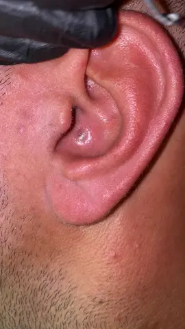 #trend_barbershop #skincare #رؤوس_سوداء #تنضيف_بشرة 