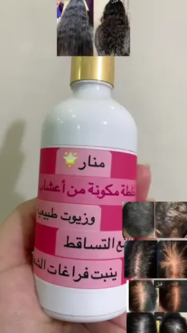 باي باي مشاكل الشعر #شعب_الصيني_ماله_حل😂😂 #فرنسا🇨🇵_بلجيكا🇧🇪_المانيا🇩🇪_اسبانيا🇪🇸 #بلجيكا🇧🇪_بروكسيل_المانيا_فرنسا_هولندا❤ 