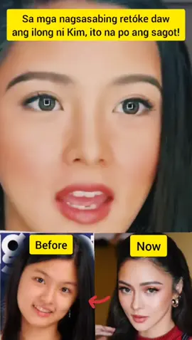 #fyp #kimchiu 