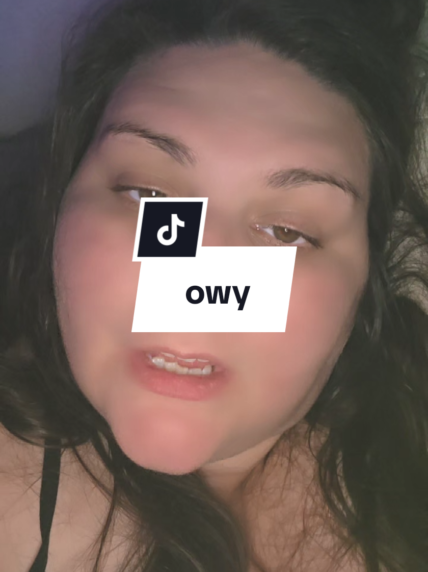 chronic migraines suck.... #migraines #pain #chronicmigraine #botox 