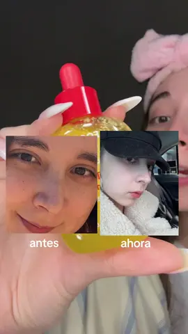 Una razón más para usar vitamina C❤️ si ustedes tienen manchas en la cara la mejor solución es un serum de vitamina C @EQQUALBERRY #eqqualberry #hyperpigmentation #vitaminc #aclararlapiel #skincare 