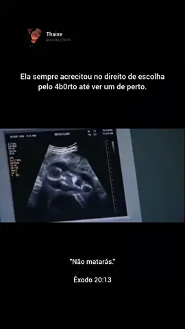 Se confessarmos os nossos pecados, ele é fiel e justo para perdoar os nossos pecados e nos purificar de toda injustiça. 1 João 1:9 ✨ Quem esconde os seus pecados não prospera, mas quem os confessa e os abandona encontra misericórdia. Provérbios 28:13 ✨ Se você fez um 4b0rto, saiba que Deus quer lhe perdoar e restaurar. O 4b0rto é errado, mas pode ser perdoado, se você se arrepende. Jesus apaga todos os pecados. Se você conhece alguém que fez um 4b0rto, seja misericordioso. O cristão deve agir com amor e compaixão, não ódio e condenação. #fyp #fyppppppppppppppppppppppp #fy #fyyyyyyyyyyyyyyyy #jesus 