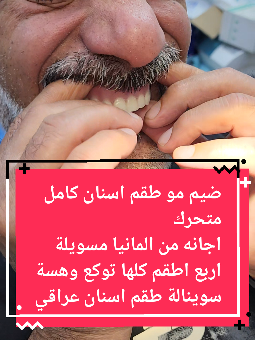 #طقم_اسنان_كامل_متحرك #اطقم_اسنان #تركيبات_الاسنان #بغداد #شارع_فلسطين 
