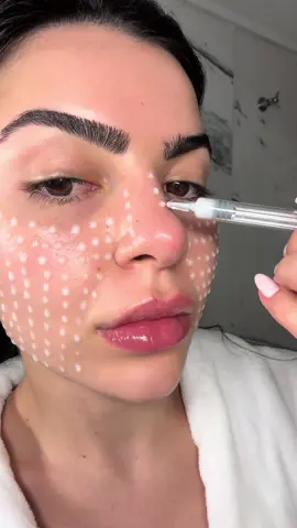 SKINCARE COREANO COM MICROAGULHAS 🪡 melhora a textura da pele e a absorção dos produtos de skincare… simplesmente surreal! Skincare coreano está em 2050!  Reedle shot 100 da @vtcosmetics_latam  Codigo de desconto: GLORLRSAF   https://shopee.com.br/VT-COSMETICS-Reedle-Shot-50-100-300-700-(30ml-50ml)-i.920292999.21195351321 #vtcosmetics #reedleshot #microneeding #kbeauty #skincare 