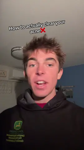 FLASH SALE!! Ends tomorrow… don’t wait! #acne #acnetreatment #seraph 