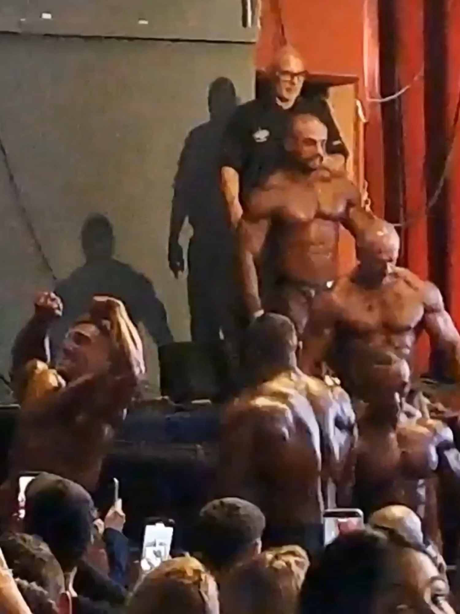 Exceso de masa muscular