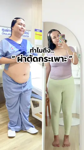 ทำไมถึง...ผ่าตัดกระเพาะ ❓ #ผ่าตัดกระเพาะ #ผ่าตัดกระเพาะลดน้ําหนัก #ลดน้ําหนัก #aumza_studio 