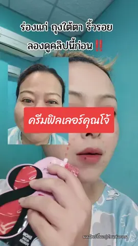 ครีมฟิลเลอร์คุณโจ้ใครที่หน้าแก่หน้าเหี่ยว ฝ้าฝังลึก ตัวนี้เลย #ของดีบอกต่อ #สินค้าปังดันยอดขาย #เอ้เอ้บอกต่อ #ครีมฟิลเลอร์ทาผิวหน้าตึง #ครีมฟิลเลอร์คุณโจ้ 