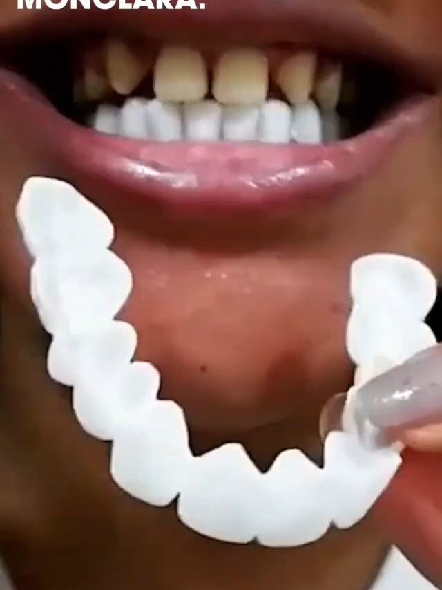 Mejora tu apariencia sin gastar de más, logrando una sonrisa perfecta al instante.