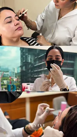 La precisión es clave para un resultado natural.  No se trata de la cantidad, sino de dónde se aplica. ✨ Mapear los músculos y dosificar correctamente garantiza que solo se relajen las zonas que forman la arruga, sin afectar el resto de tu rostro. ¿Quieres agendar tu cita? 🔽 Inbox | DM | WhatsApp https://bit.ly/2Dz9zn5 | (81) 1612 1858 🌐 doctoralia.com.mx/stella-villarreal-garza 📍 Centro Médico Hidalgo Dra Stella Villarreal 👩🏻‍⚕️ Medicina Estética y Longevidad UDC Cédula 11077514 Aviso de Publicidad 203300202A0272 #VIVEHaB #MedicinaEstética #DraStellaVillarreal #Rejuvenecimiento #PielRadiante  