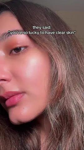 luck? where? #GlowUp #skintok #clearskin #hellothea #acne 