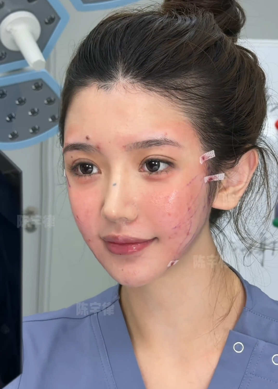 Too much volume can make your face look heavy — not young. The 9D Facelift refines, lifts, and restores your natural contour. Light face, tight skin, youthful glow — all in one design. ✨ #9DFacelift #FacialLift #FacialRejuvenation #ContourDesign #VFace     