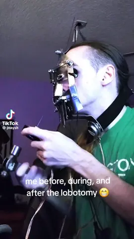 🫩 #wtf #100daysofyap #fyp #lobotomy 