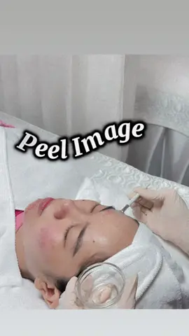 Peel Image - Giải pháp an toàn cho làn da mụn 🫣🫶 #xuhuong #peel #image 