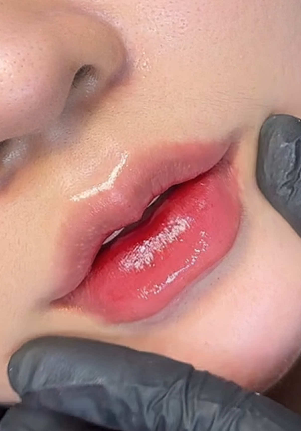 Dáng môi hai quả cho ce  nè Lấy video cho bé 1tim nạ #tiêmfullface #tiêmfille #xuhuong 