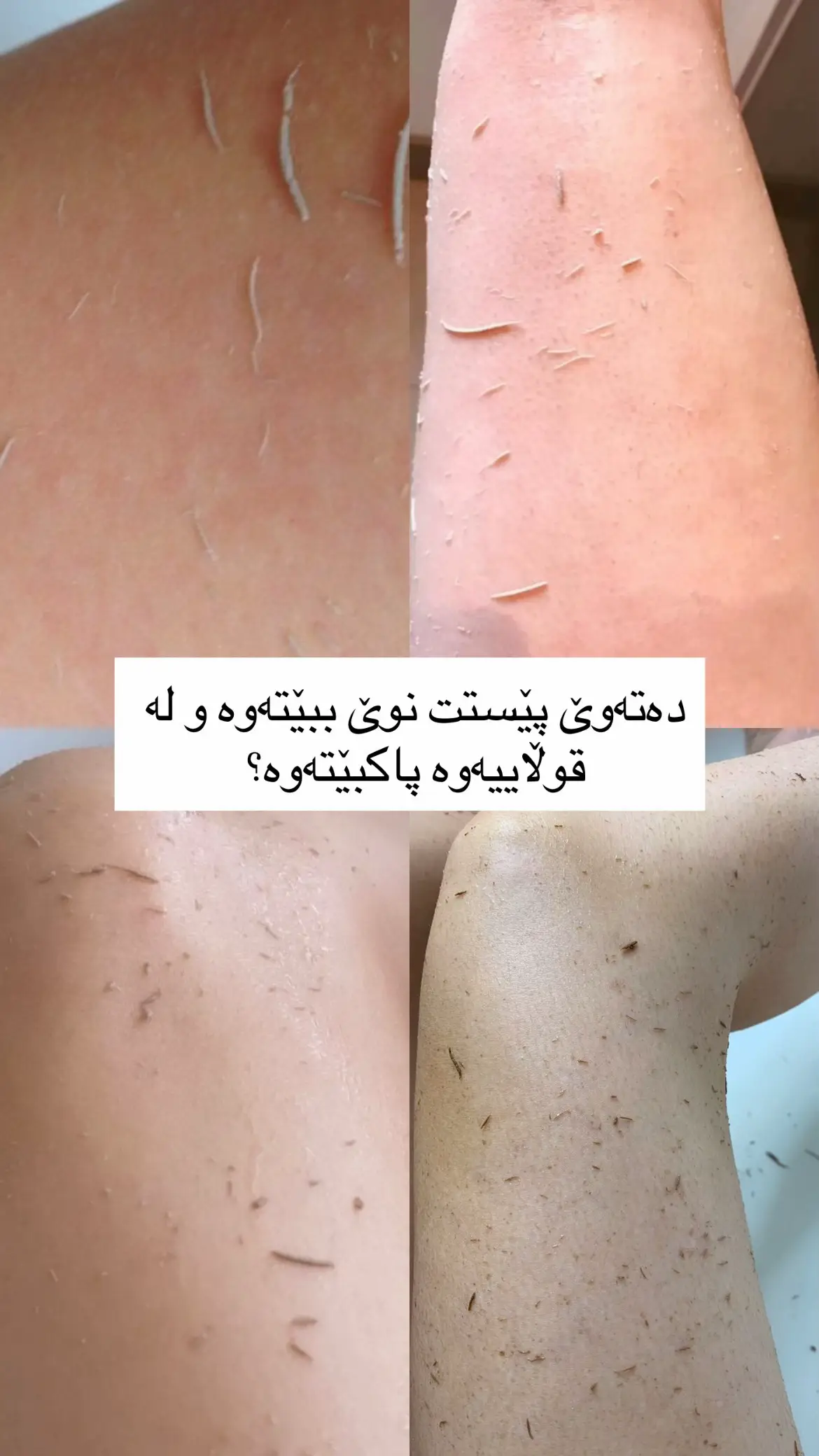 سێتی نیللی مەغریبی👌🏻💙  بۆ نەرم کردن و سپی کردنی تەواو جسم سپی کردنەوەی جسم ٤ تا ٨ دەرەجە💙 پێستی مردوو لادەبات پێست پاکدەکاتەوە و سترەوبێری بە تەواوی چارەسەر دەکات پاکڕاگرتن و بۆن خۆشکردنی تەواوی جەستە بۆ ماوەی ٣ ڕۆژ زیاتر بە تەواوی پێست نەرم و بریسکە دار دەکات سێتی نیلی مەغریبی 💙:- ئەم سێتە لە شەش پارچە پێکهاتوە  ١-سکڕەبی نیلی مەغریبی  ٢-سابونی شلی نیلی مەغریبی  ٣-لۆشنی جسم ٤-مسک ٥-عەترێکی جسمی بریسکە ٦-لفکەی مەغریبی * سودەکانی ئەم سێتە (بۆ هەموو جسم بەکار نایەت یانی بۆ مەنتق حەساس گونجاو نیە بێجگە لە ڕوخسار،تایبەتە بە یەکڕەنگ کردنەوەی جسم  و سپی کردنی ،تۆخی و دووڕەنگی ناهێڵێت  چارەسەری پێستی سترۆوبێری دەکات و پێست نەرم و شێدار دەکات ،ڕەونەقیدەداتێ و بۆنی جسم خۆشدەکات ** بەکارهێنانی سێتی نیلی مەغریبی  *سکڕەبەکەی هەفتەی دوو جار بەکاردێت (با پێستت شێداربێت کەمێک لە سکڕەبەکە بکە سەر دەست و بە شێوەیەکی بازنەیی دە خولەک مەساجی پێ بکە ) *سابونی شل (هەموو خۆشۆردنێک دەتوانی بەکاری بهێنیت،یان هەموو ڕۆژێک) *لۆشنی جسم (لەدوای هەموو خۆشۆردنێک بەکاری بهێنە و شەوان پێش خەوتن بەکاریبهێنە، زۆر گرنگی پێ بدە بۆ ئەو ناوچانەی دوو ڕەنگن)وا باشترە تا پێستت لۆشنەکە هەڵدەمژێک جل لەبەر نەکەیت  *مسک و بۆنی جسم و لفکەی مەغریبی بەپێی ئارەزوی خۆت #foryou #tiktok #cosmetics #بۆداواکردن_نامەبنێرن💌📨 