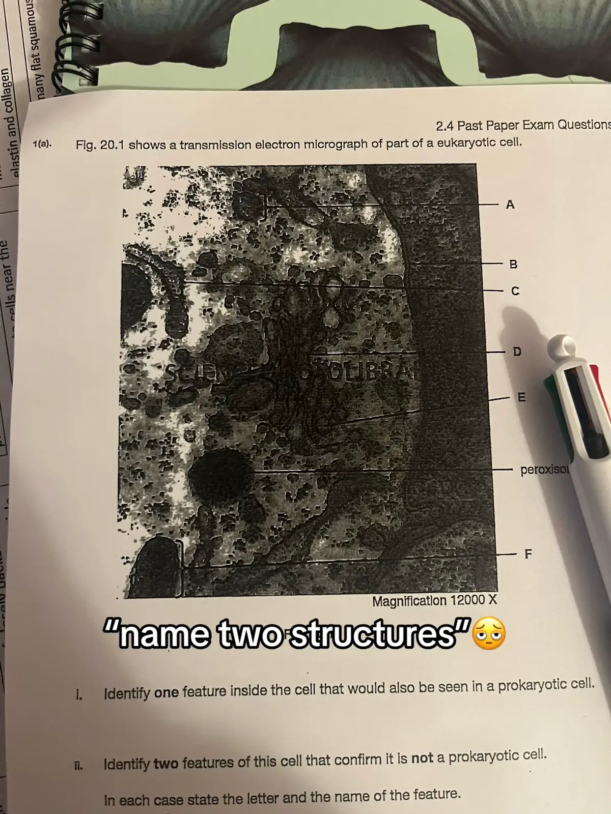 literally can barely distinguish between anything , I CANT SEE ANYTHING the printing is horrible #alevels #alevelbiology #biology 