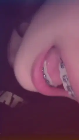 #شفه على شفه تخفف من ألأ ألمالثهه😕