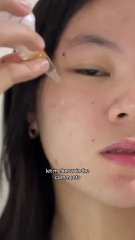 #stitch with @Trishia Espeña been using this salmon sperm on my face and this is what happened 😳  #GenabellePH #radianskineveryday #skincarethatworks #rhodemarketing @Genabelle PH @rhodemediamarketing 