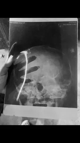 សប្បាយជាមួយខ្ញុំឲហើយទៅមិនយូទេលេងមានវត្តមានខ្ញុំហើយ💔👋🏻😆#ជំងឺបាក់ទឹកចិត្ត 💔