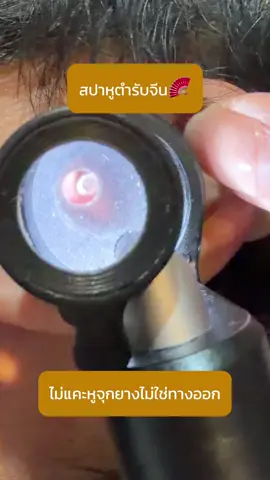 ลาบัวRCA,ลาบัว อารีย์ สปาหูตำรับจีน นวดศีรษะ และสระผมผ่อนคลาย ใครใช้ไม้แคะหูจุกซิลิโคนต้องระวังค่ะ วันนี้คุณลูกค้ามาให้กวางคีบออกให้ค่ะ บางครั้งจุกหลวมก็ทำให้หลุดเข้าไปข้างในได้ค่ะ #สปาหูกรุงเทพ #ลาบัวสปาหู #สปาหูฟินๆ #ลาบัวสปาหูRCA #สปาหูพระราม9 