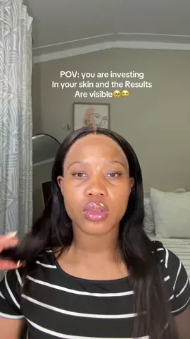 Investing in my skin is definitely the best decision I made🥹❤️ #fyp #SkinCare101 