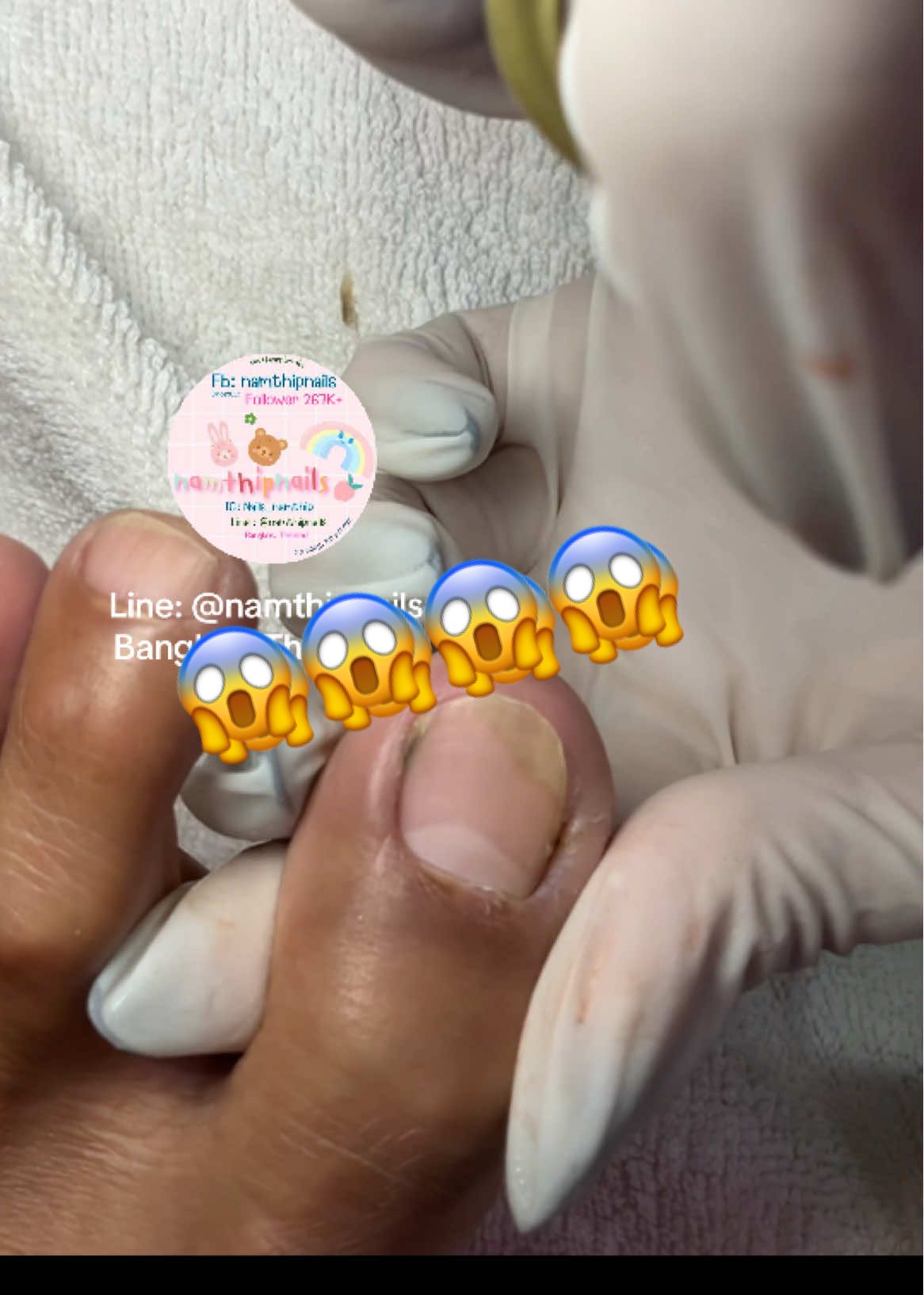 💓 #namthipnails #ตัดเล็บขบ #ตัดหนัง #ทำเล็บ #ร้านตัดเล็บขบ      Fb : namthipnails  Line : @namthipnails  
