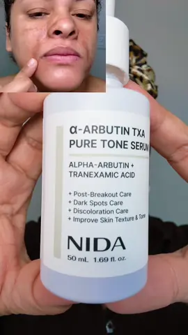 Nida serum para eliminar manchas oscuras  #nida #serum #hyperpigmentationskincare #tiktokshopfalldealsforyou #tiktokshopblackfriday 