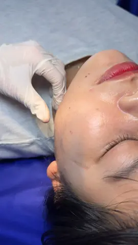 Tặng các nàng clip hem logo 😘😘 #Change_Medical_Aesthetic#Changr_Medical_Aestheticr 