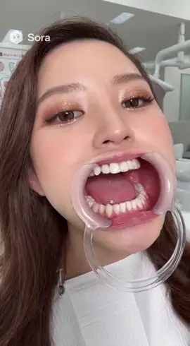 #ホワイトニング 