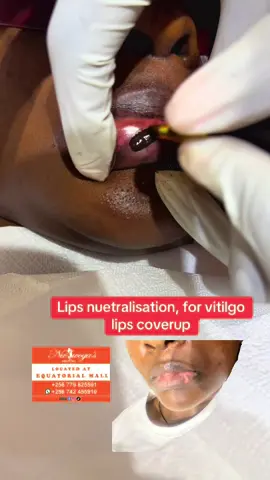 #kampala_uganda🇺🇬🇺🇬🤝 #viral #kampala_tiktokers #lipblush 
