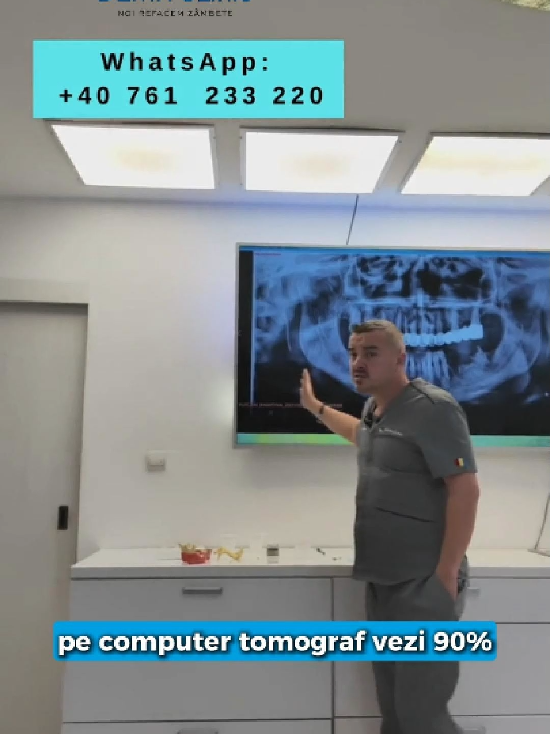🦷 Maria ne întreabă: „Există șansa ca un medic să nu fi făcut o radiografie dentară și să nu fi văzut o infecție?” Da, se poate întâmpla — și e mai frecvent decât crezi. Radiografia clasică oferă o imagine 2D, iar uneori, din cauza bulelor de aer sau a unghiului, anumite infecții nu se văd deloc. 😬 Un computer tomograf (CT), în schimb, arată structurile în 3D și poate evidenția exact locul infecției, chiar dacă nu există durere sau alte semne evidente. 🔍 👉 De aceea, la Denta Clinic, realizăm CT-ul dentar înaintea oricărei lucrări importante. Pentru că un implant sau o coroană scumpă trebuie pusă doar pe o bază sănătoasă — nu peste o infecție ascunsă. 📍 Denta Clinic – Calea București 193A, Râmnicu Vâlcea 📞 WhatsApp: +40 761 233 220 🌐 www.dentaclinic.ro 🔗 linktr.ee/dentaclinic.vl #DentaClinic #RadiografieDentara #CTDent #InfectiiDentare #CiprianDeaconu #ImplanturiDentare #ZambetSanatos #EducatieDentara