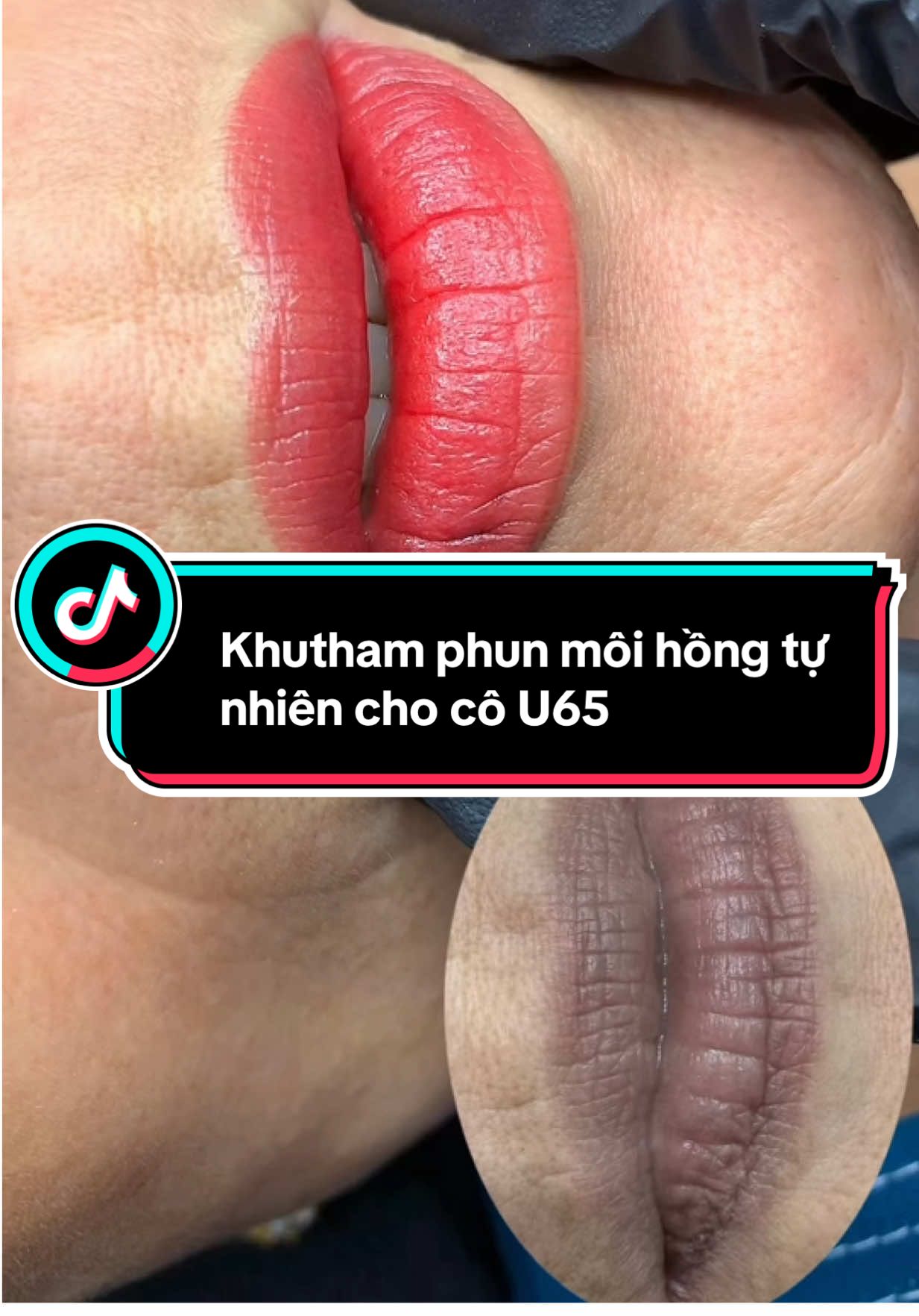 Thay đổi màu sắc đôi môi cho cô khách trở nên dạng dỡ . Cảm ơn mọi người luôn yêu thương và tin tưởng .#phunmôi #phunmoitunhien #phunmoidep #xuhuongtiktok #liptatoo 