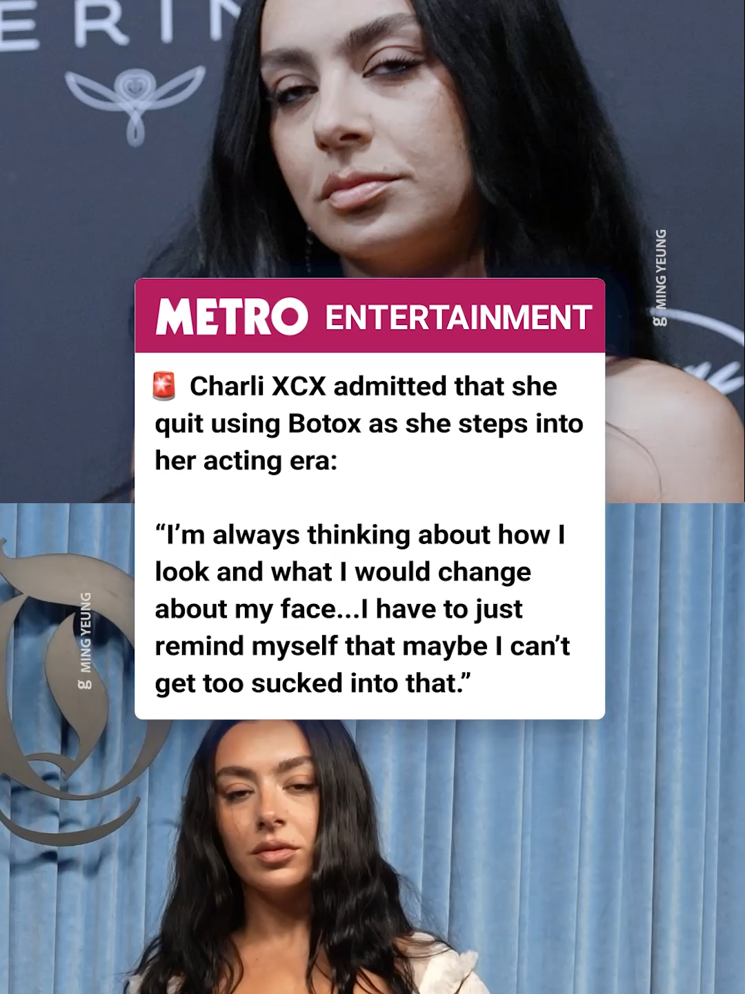 @charlixcx has spoken openly about decisions she made ahead of stepping into her acting era 🍏 In an interview with @vanityfair Charli admitted that she quit using Botox because of her pursuit of acting. “I did a couple of audition tapes where I had Botox, and my eyebrows were doing that crazy thing when they kind of lift,